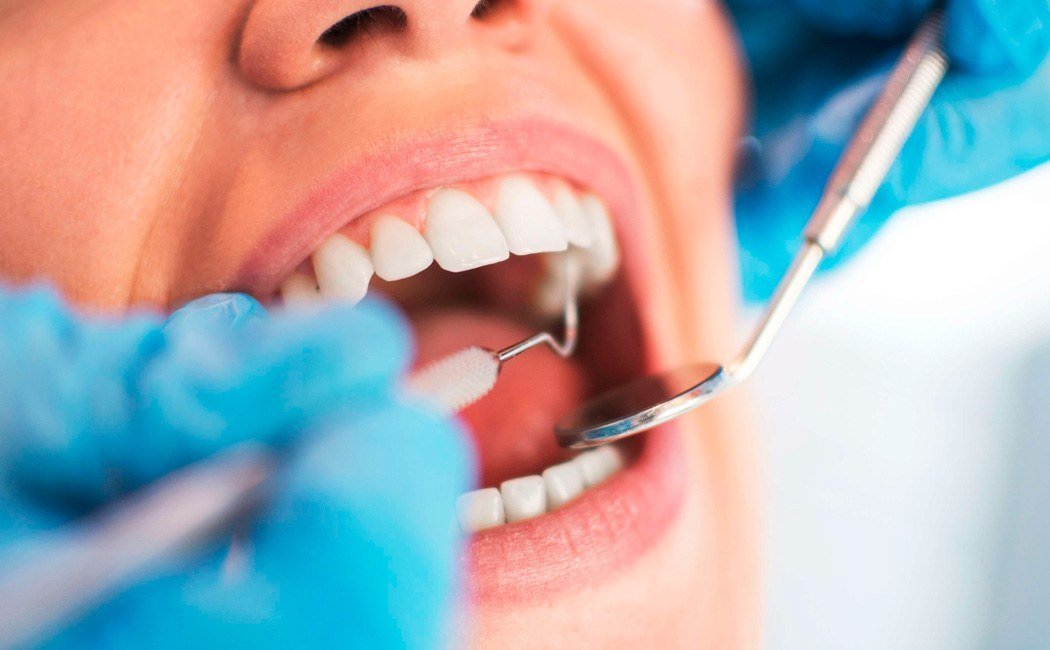 Limpeza dentária e prevenção odontológica