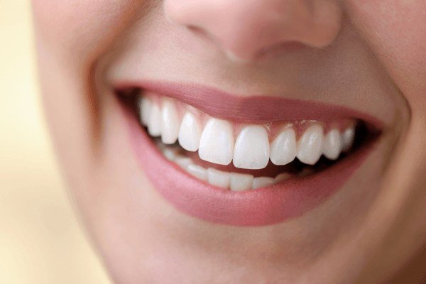 Tratamento estético de clareamento dental